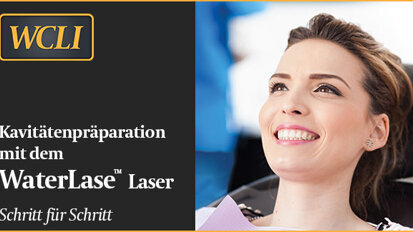 Kavitätenpräparation mit dem Laser – Schritt für Schritt