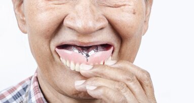 戴义齿入睡会增加高龄人群患肺炎的风险