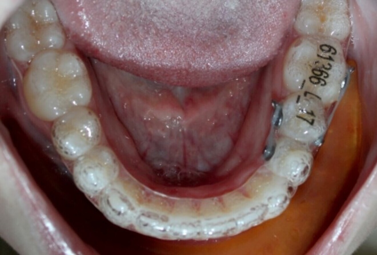 Fig. 2: Underway with rotational couples.