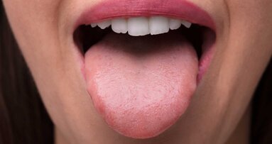 Glossodynie: Ursachen für Zungenbrennen