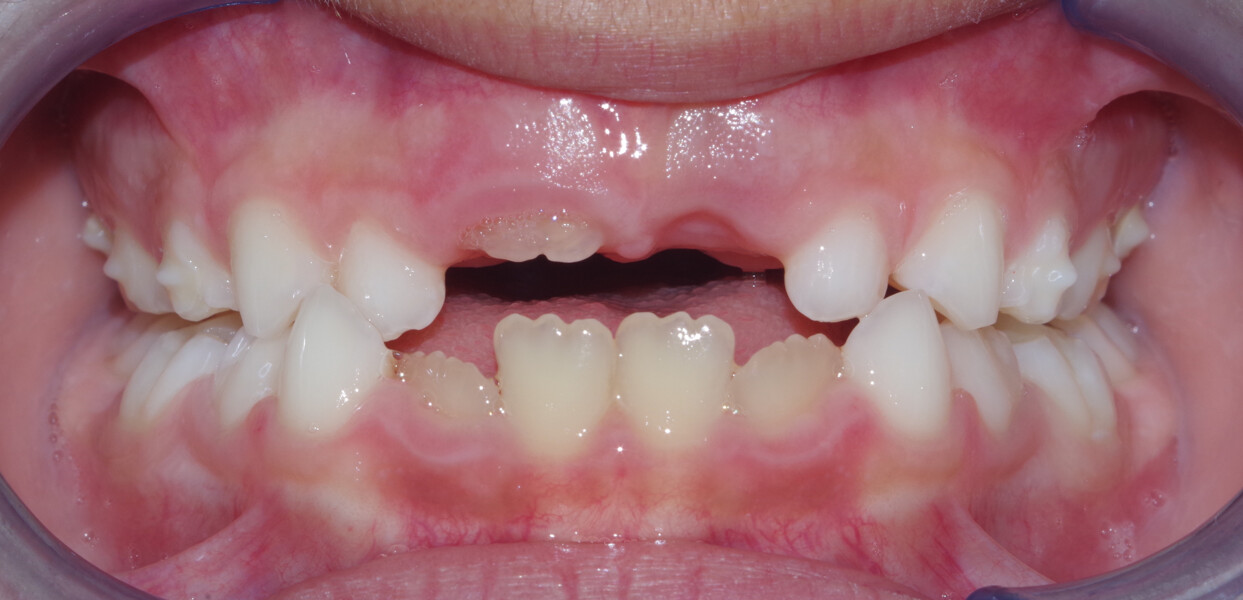 Fig. 7b: Frontal view.
