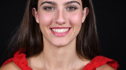 Addressing smile aesthetics with digital orthodontic planning and treatment: A case report