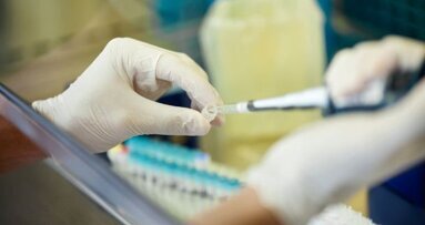 Японски учени откриват нов антисептичен агент за борба срещу пародонтита