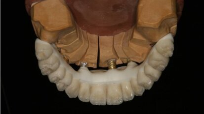Korony teleskopowe nowej ery – część 2