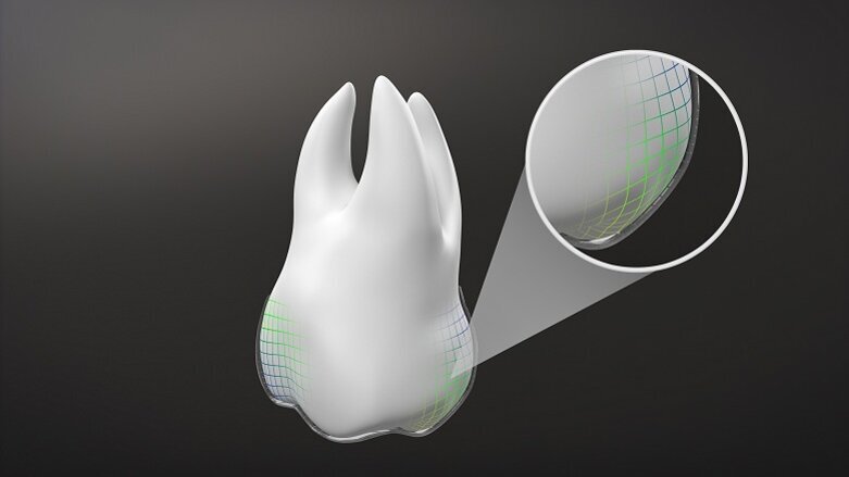 Invisalign G8, Türkiye’de Piyasaya Sunuluyor