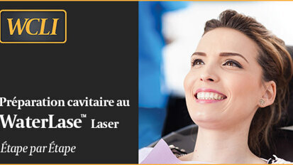 Préparation cavitaire au laser étape par étape