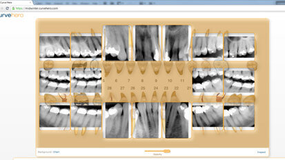 Curve Dental’s new Web-based digital imaging technology poised to change how dentists capture, store and access patient information Curve Dental’s new Web-based digital imaging technology poised to change how dentists capture, store and access patient information