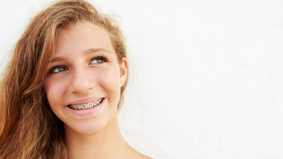 Teenager finden Zahnspangen hipp