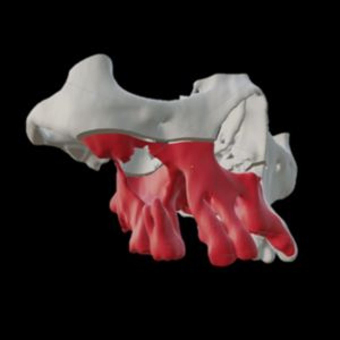 Fig. 1: Mapping the resection margin of the tumour.