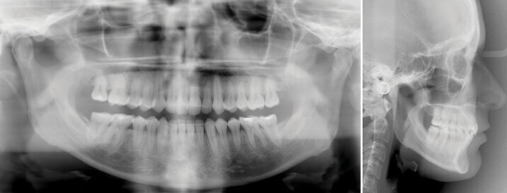 Konečná foto a RTG dokumentace