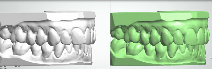 Fig. 8: Digital setup