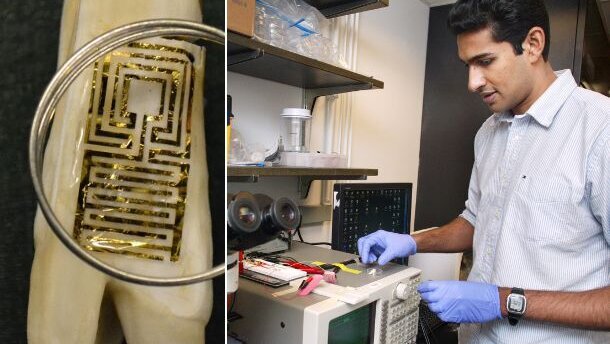 Engineers develop novel biosensor for use on teeth