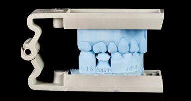 Modele 3D w stomatologii