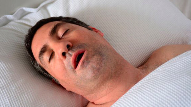 I dispositivi impiantabili riducono i sintomi dell’apnea notturna ostruttiva