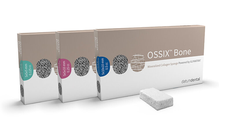 OSSIX Bone maakt botopbouw eenvoudiger
