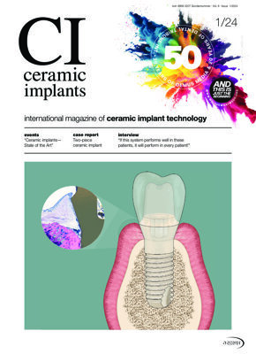 ceramic implants international No. 1, 2024