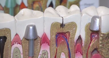 Amalgamat wciąż obecny