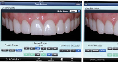 Right ‘touch’ helps patients envision new smile