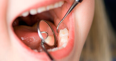 Con la crisi è boom di carie tra i bambini (+15%) (e sta crescendo anche tra i 25enni)