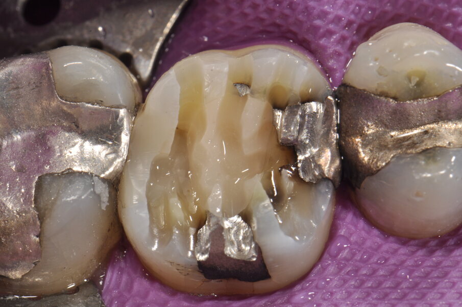 Fig. 2: Conformación de las hendiduras. 