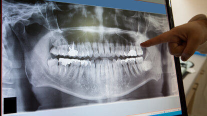 Τρόποι με τους οποίους η ψηφιακή ακτινογραφία θα βελτιώσει την καθημερινή κλινική πράξη