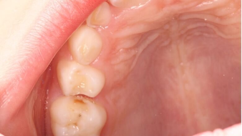 Preventie: een kwestie van volhouden