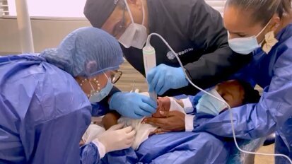 Labio y paladar fisurado Jesus video2