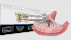 OneGuide da Osstem Implant celebra 10.º aniversário