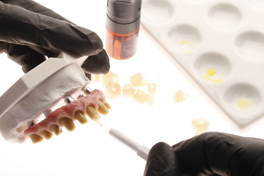 Fig. 15: Etching and pretreatment of the ceramic surfaces.