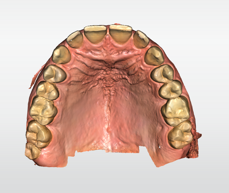 Fig. 3 - L’impronta ottica, visualizzazione occlusale.