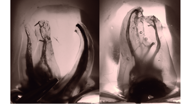 Twisted files and adaptive motion technology: A winning combination for safe and predictable root canal shaping