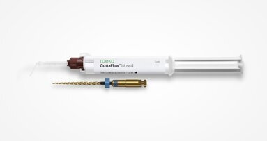 European dentists test Remover files and obturation material―a strong duo for revision work
