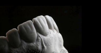 Redefining smile harmony: The concept of Hood Proportion for the  Malaysian population