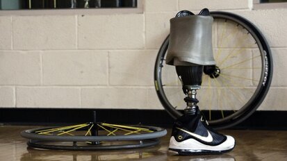 Driekwart menselijk lichaam is vervangbaar door technologie