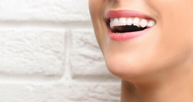 Il nuovo orientamento all’estetica e la ricerca dei “denti bianchi”