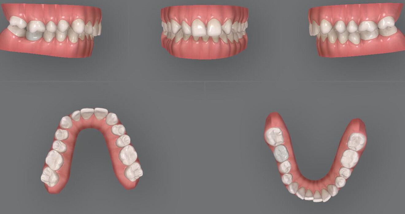 Fig. 2: Pretreatment digital models.