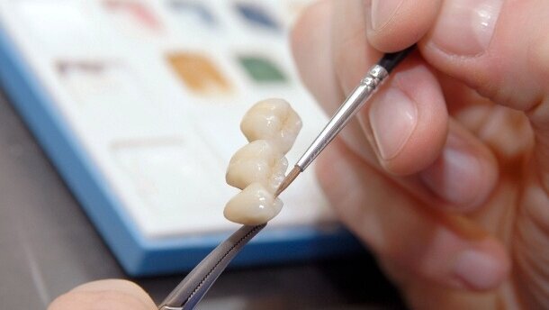 Pracownia protetyczna musi być wszechstronna