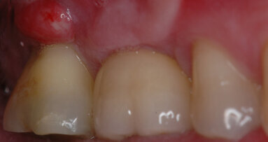 AIE propone: Caso Clinico 1