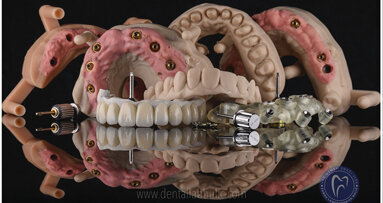 Nove tehnologije i dentalni tim - partneri u uspehu
