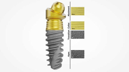 Nobel Biocare lança superfícies Xeal e TiUltra nos EUA