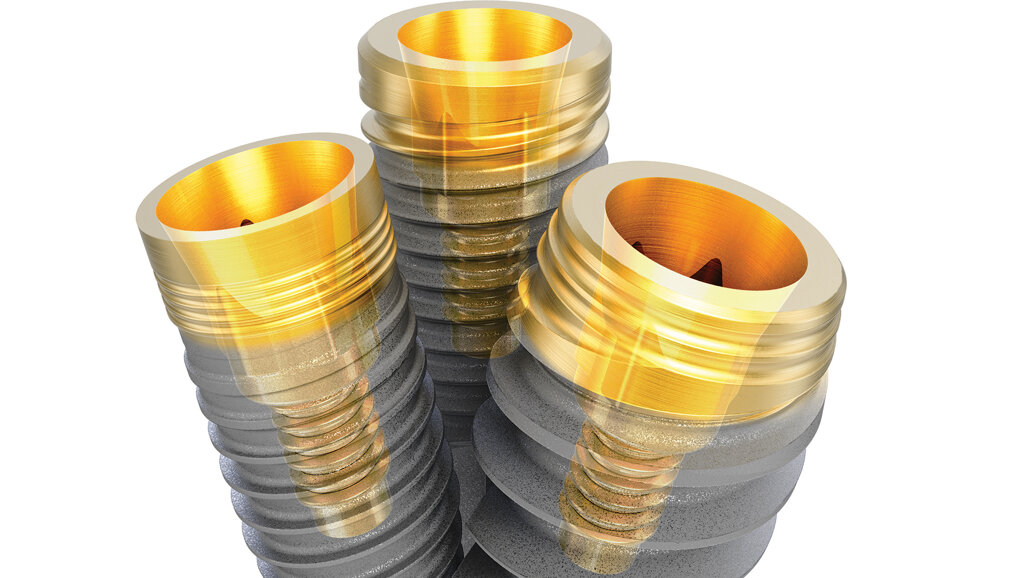 Trusted implant designs, united in one connection