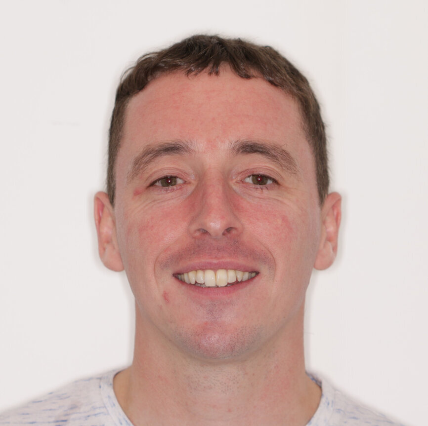 Fig. 14: Post-treatment 1