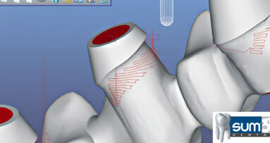 CAD/CAM dalla parte del cliente