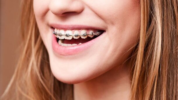 NZa past tarieven orthodontie aan