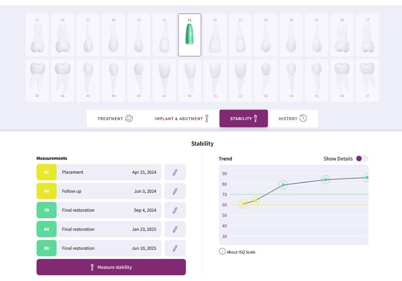 Fig. 14: OsstellConnect ISQ treatment curve mapping implant stability over 14 months.