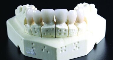 Зъботехниката: моето призвание