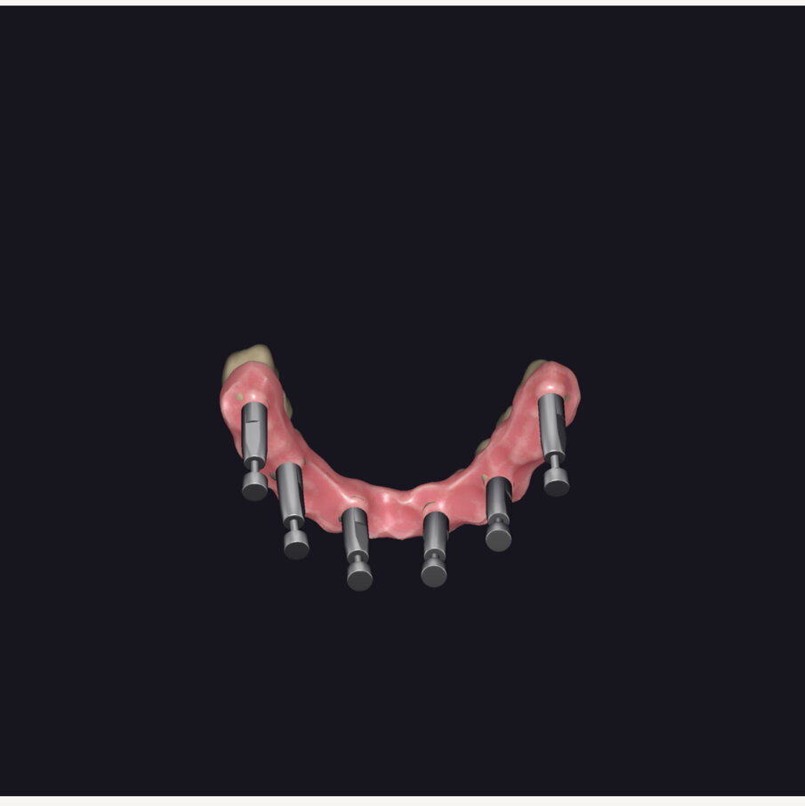 Fig. 15 - Fasi di lavoro digitale.