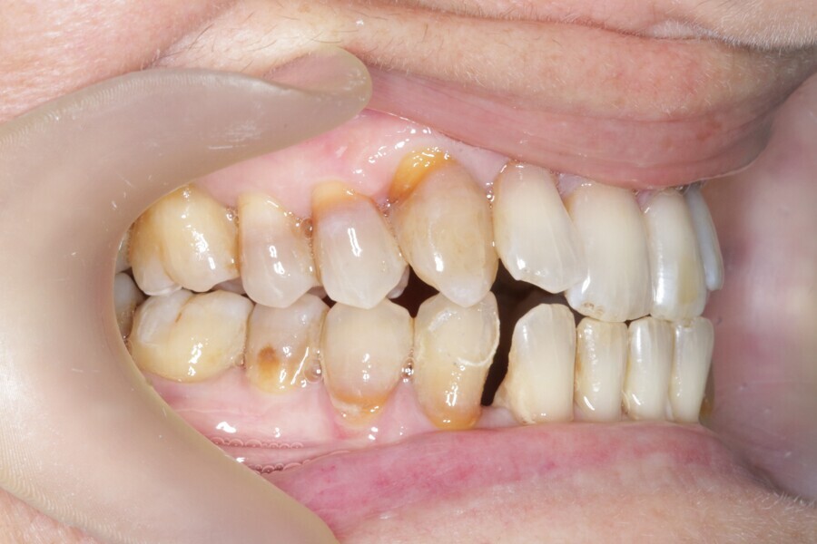 Fig. 37: Case ready to scan and submit to Reveal.