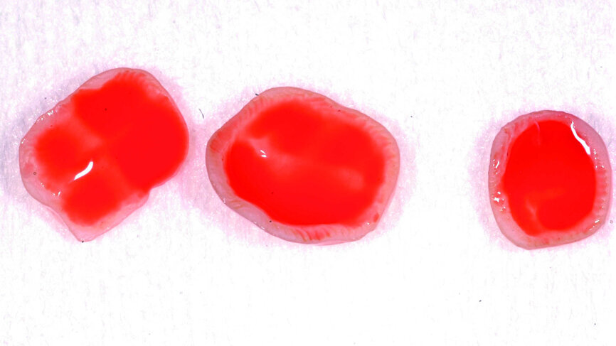 Fig. 11 : Mordançage de l’intrados à l’acide fluorhydrique 4,5 % pendant 20 secondes.