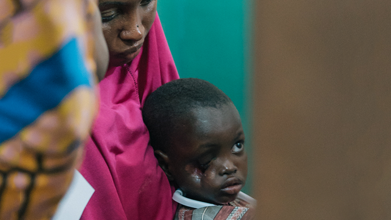 Observational study determines risk factors for noma